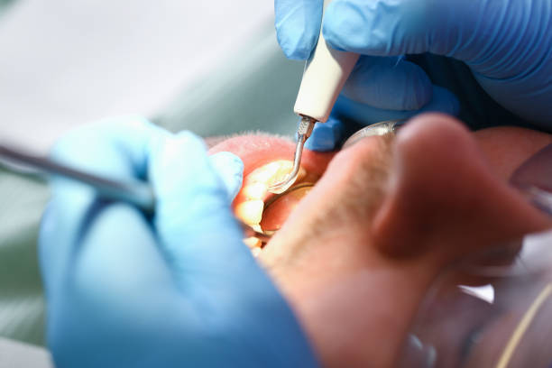 Best Emergency Dental Care for Broken or Chipped Teeth in Berwyn, IL