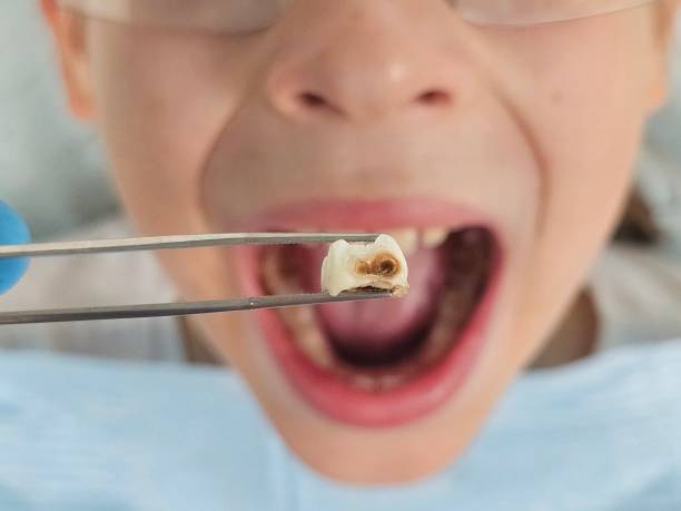 Best Emergency Denture Repair in Berwyn, IL